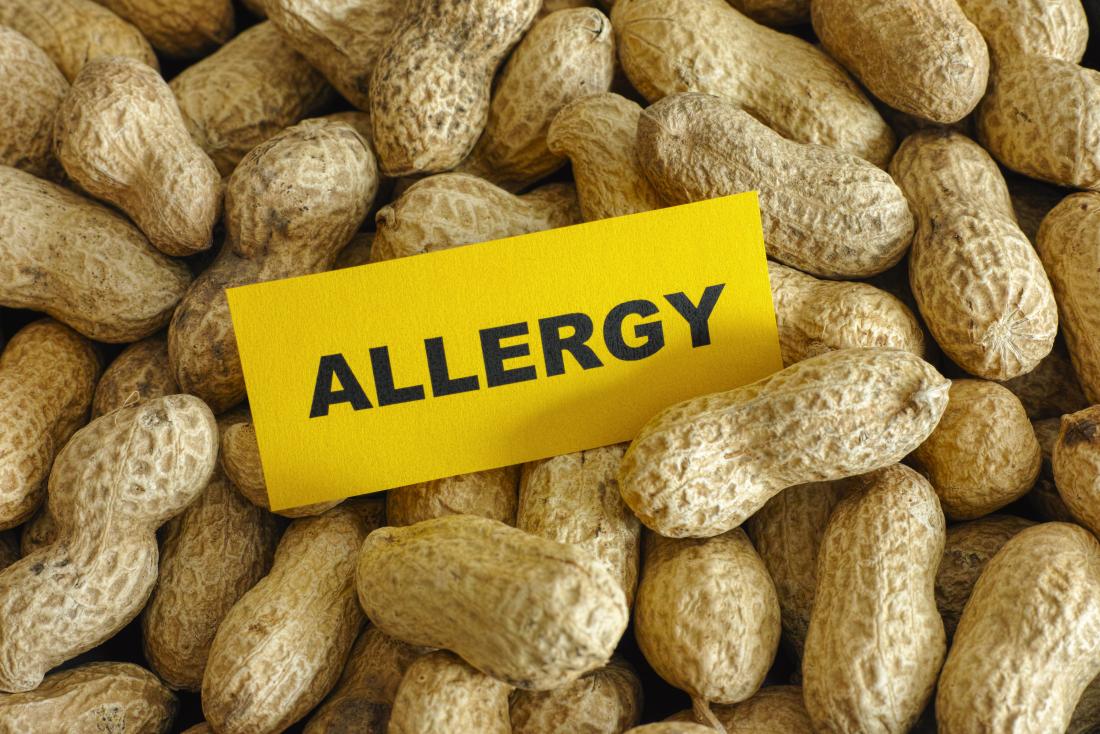 Peanut allergy: Six genes found that drive allergic reaction