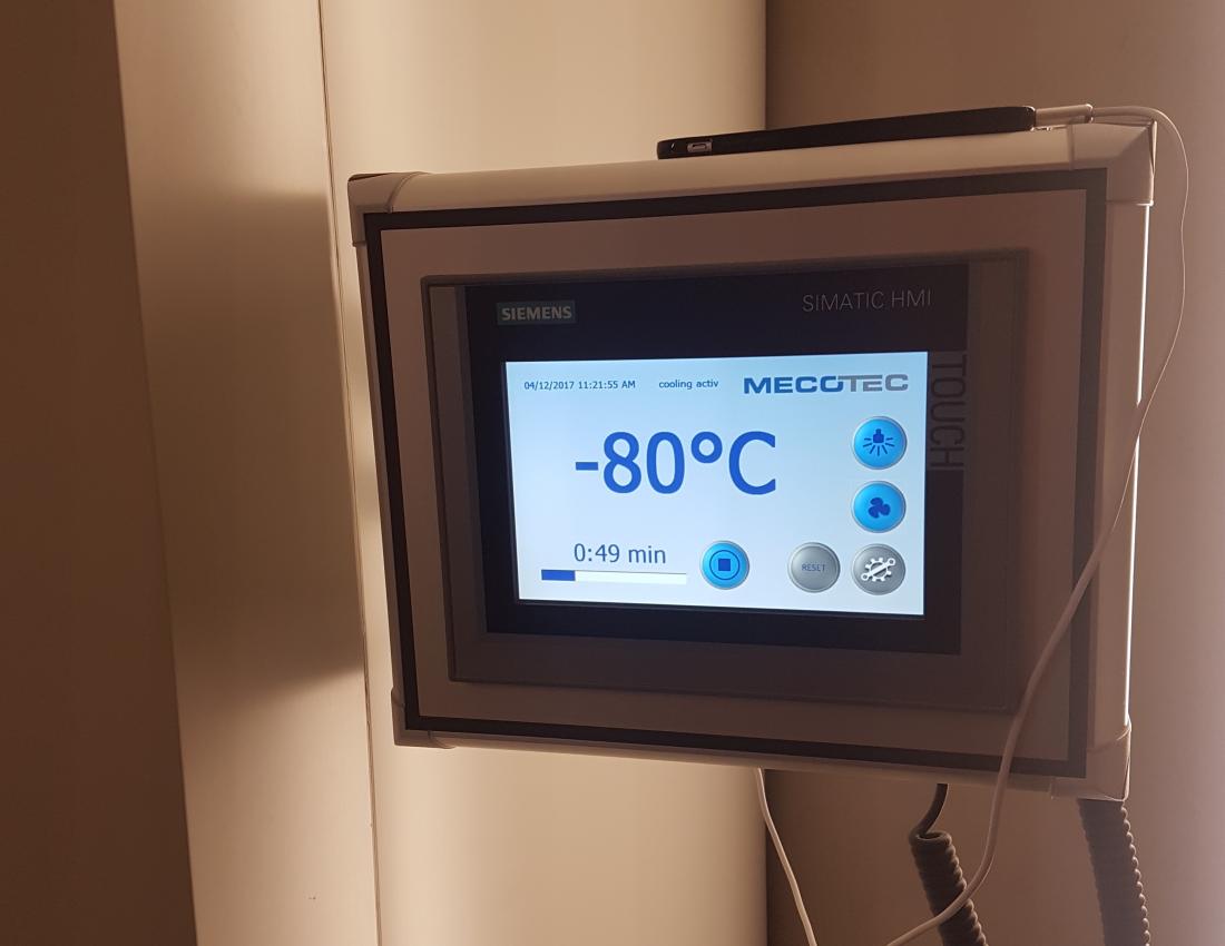 Cryochamber read out
