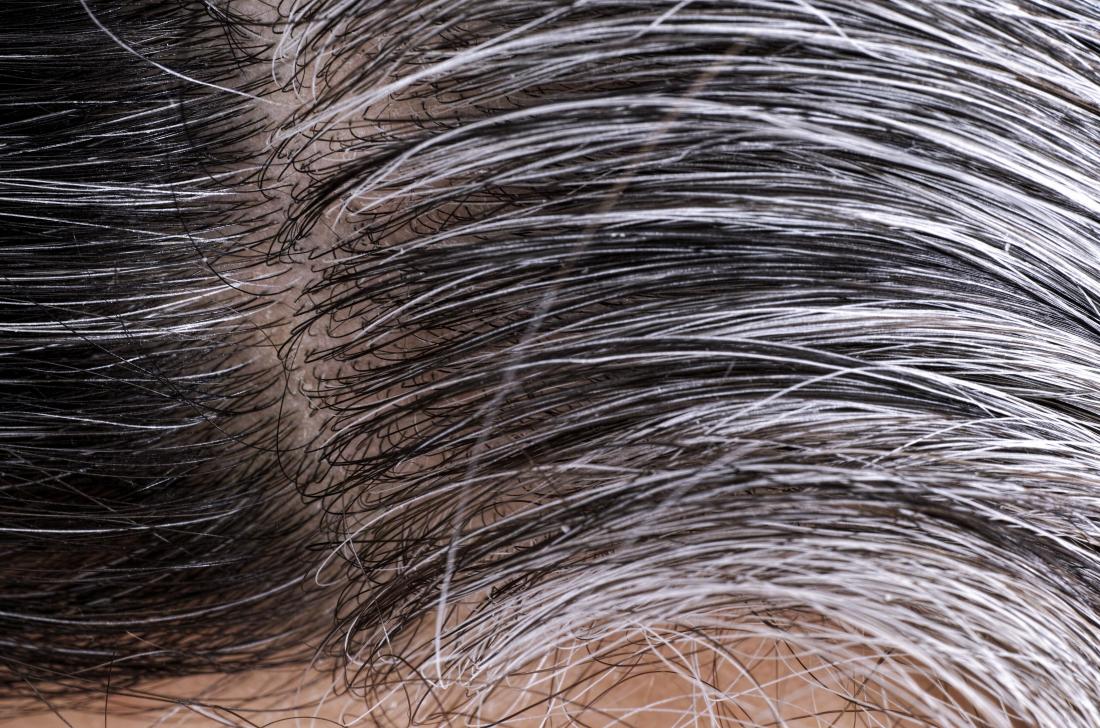 How to Get Grey White Hair 