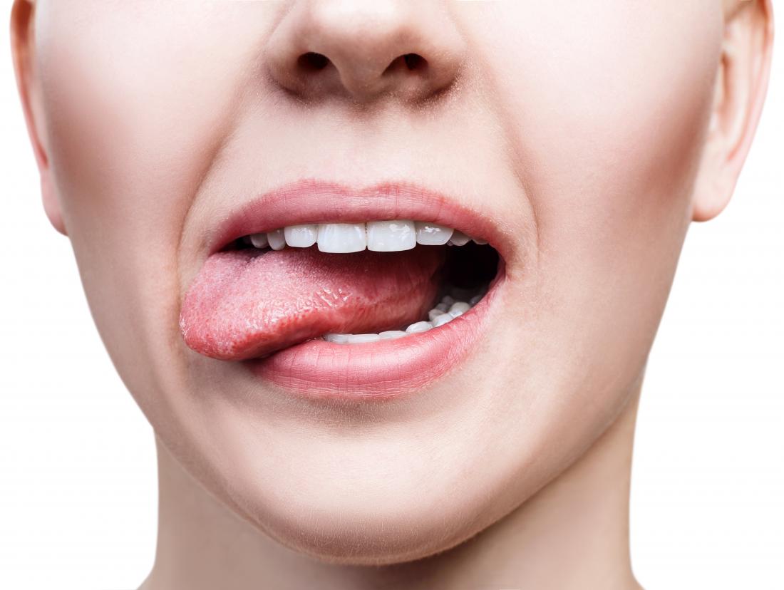 WOULD PHENTERMINE MAKE YOUR MOUTH SORES