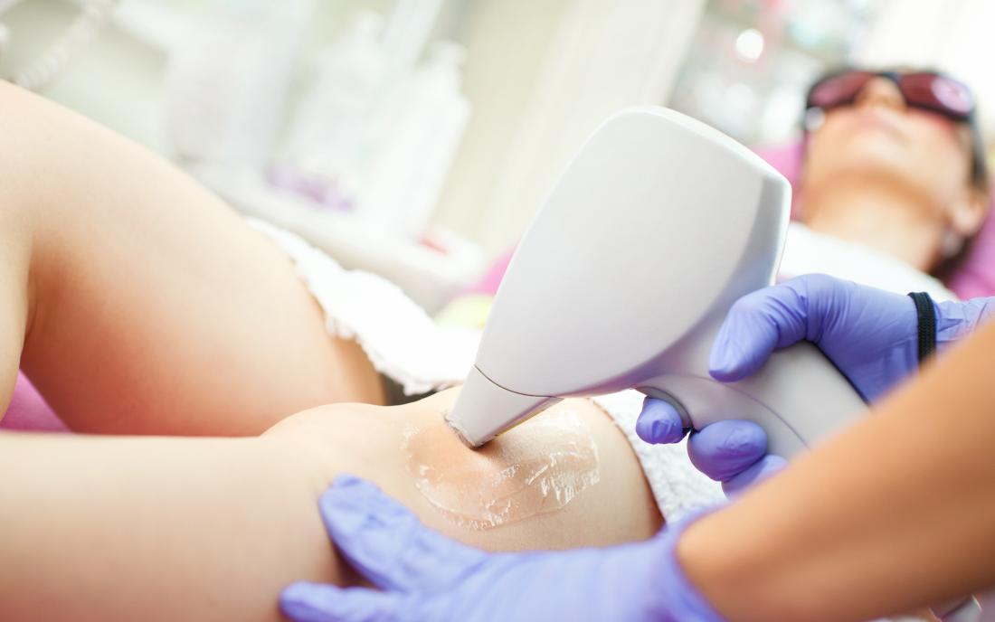 electrolysis hair removal cost in mumbai