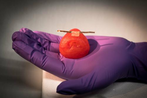 3-D prostate model