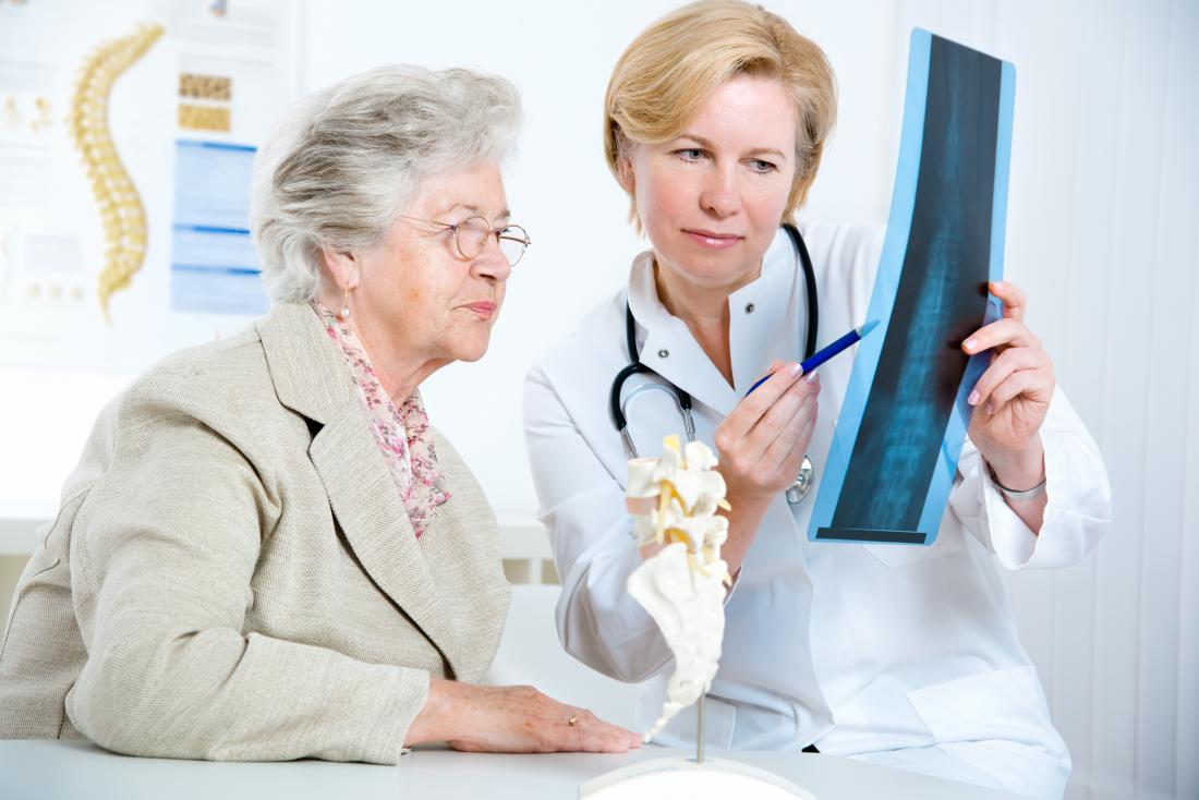 doctor and patient looking at xray of spine