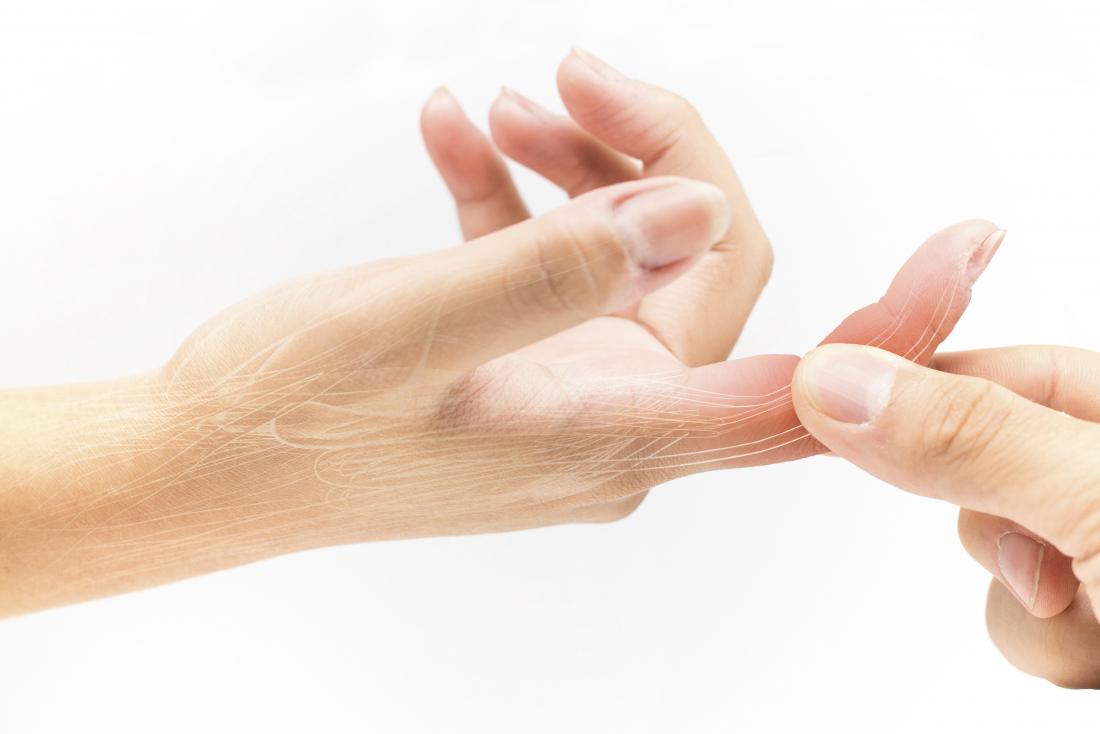 Sprained finger: Symptoms, treatment, and recovery