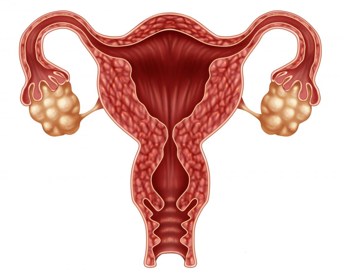 Oophorectomy: Procedure, recovery time, and side effects