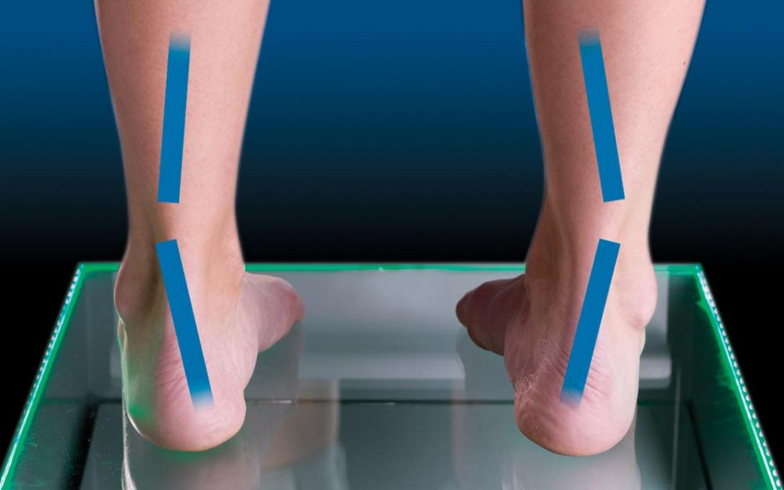 Pronation and supination while walking