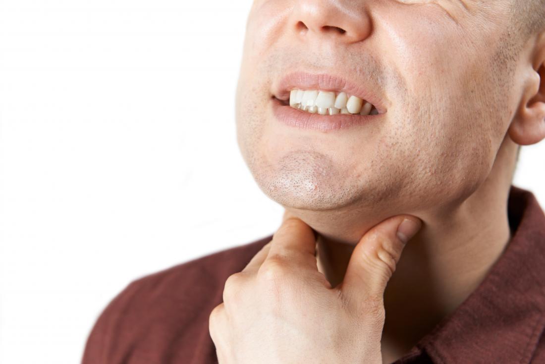 Throat ulcers: Causes, symptoms, and treatment