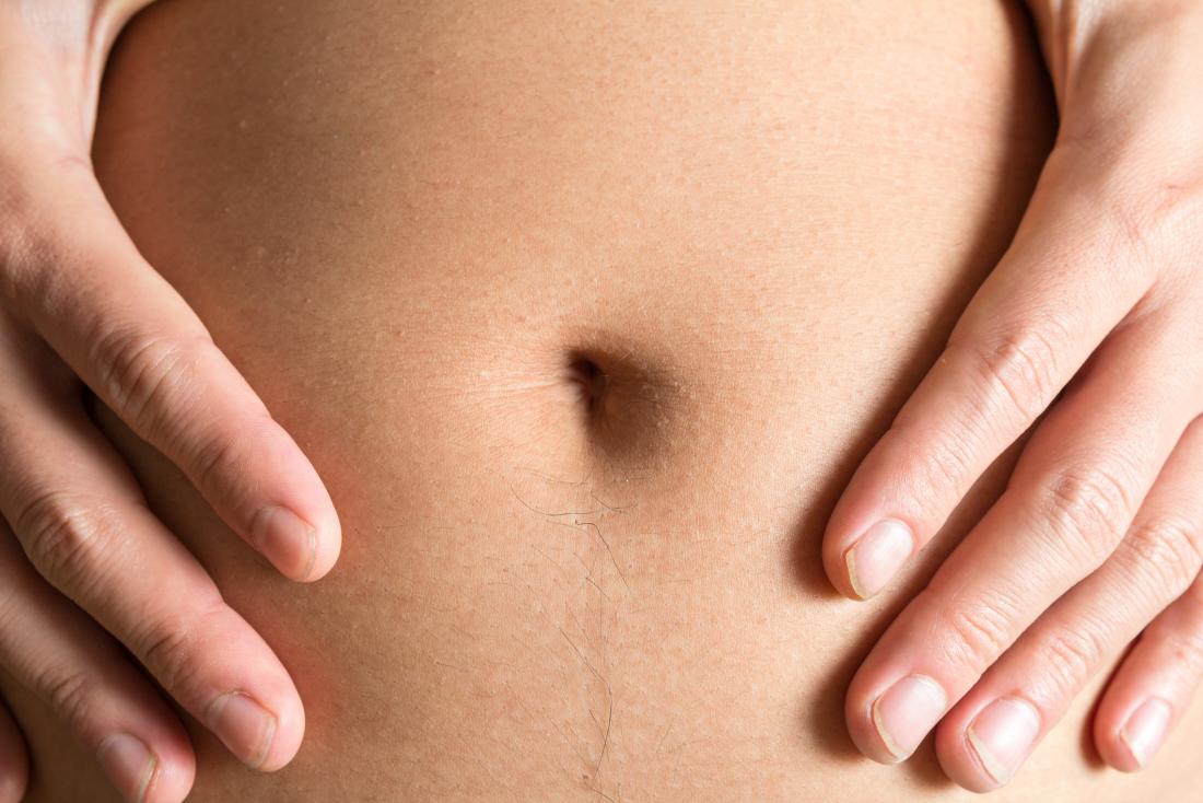 Tummy Tuck and the Belly Button - Halifax, NS, - Prince Edward Island