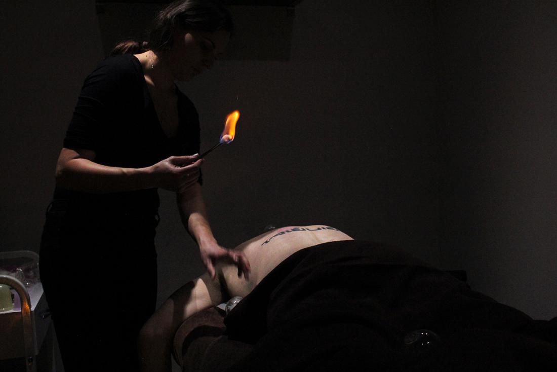 Fire cupping