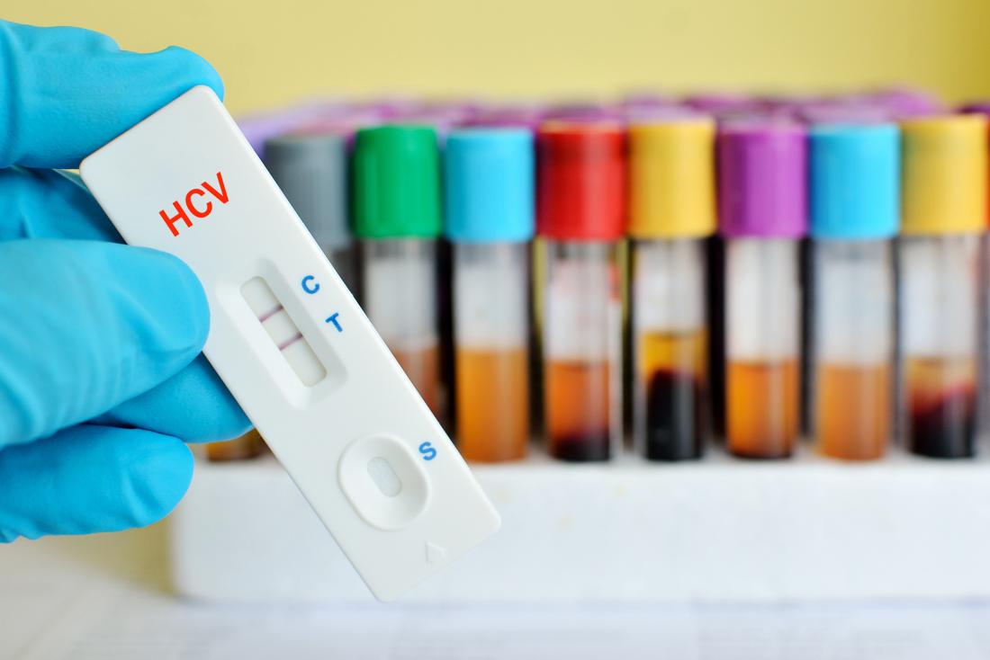 Hepatitis C test in front of blood samples.