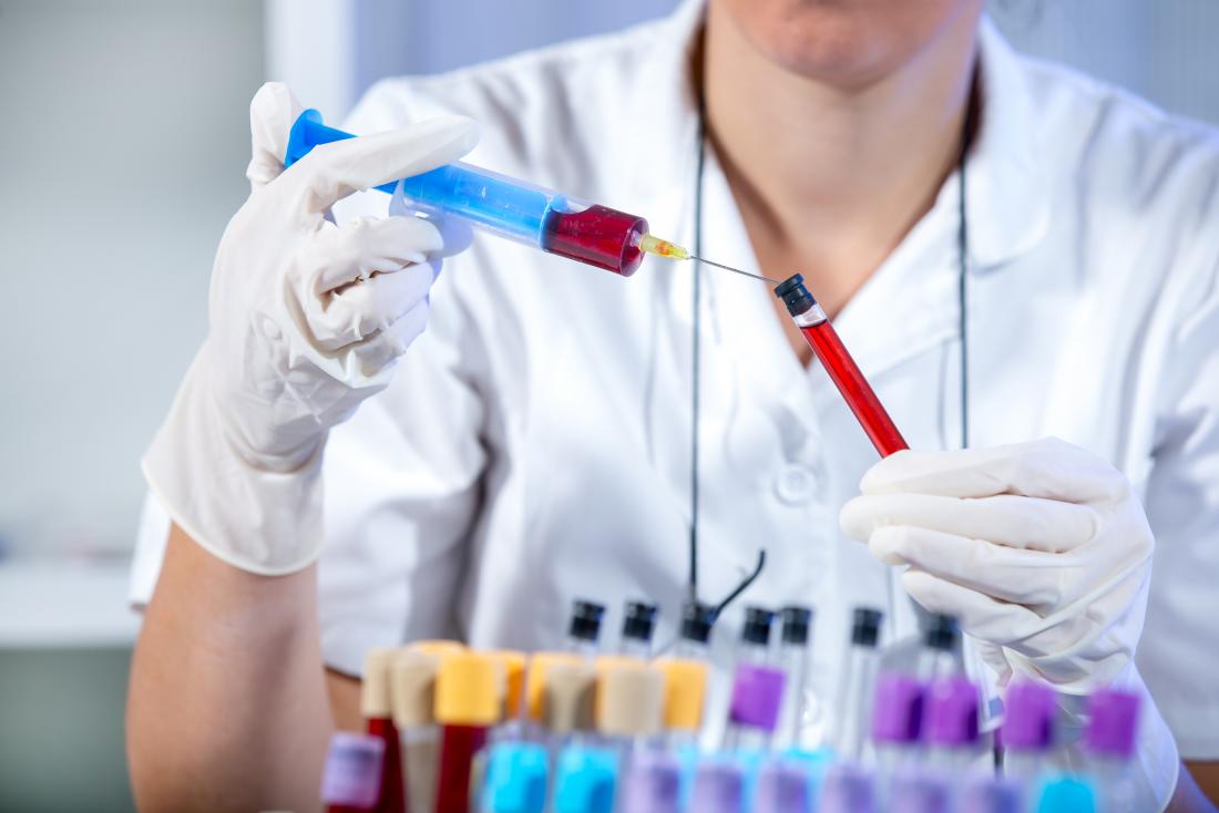 Blood sample being transferred for testing in lab by technician.