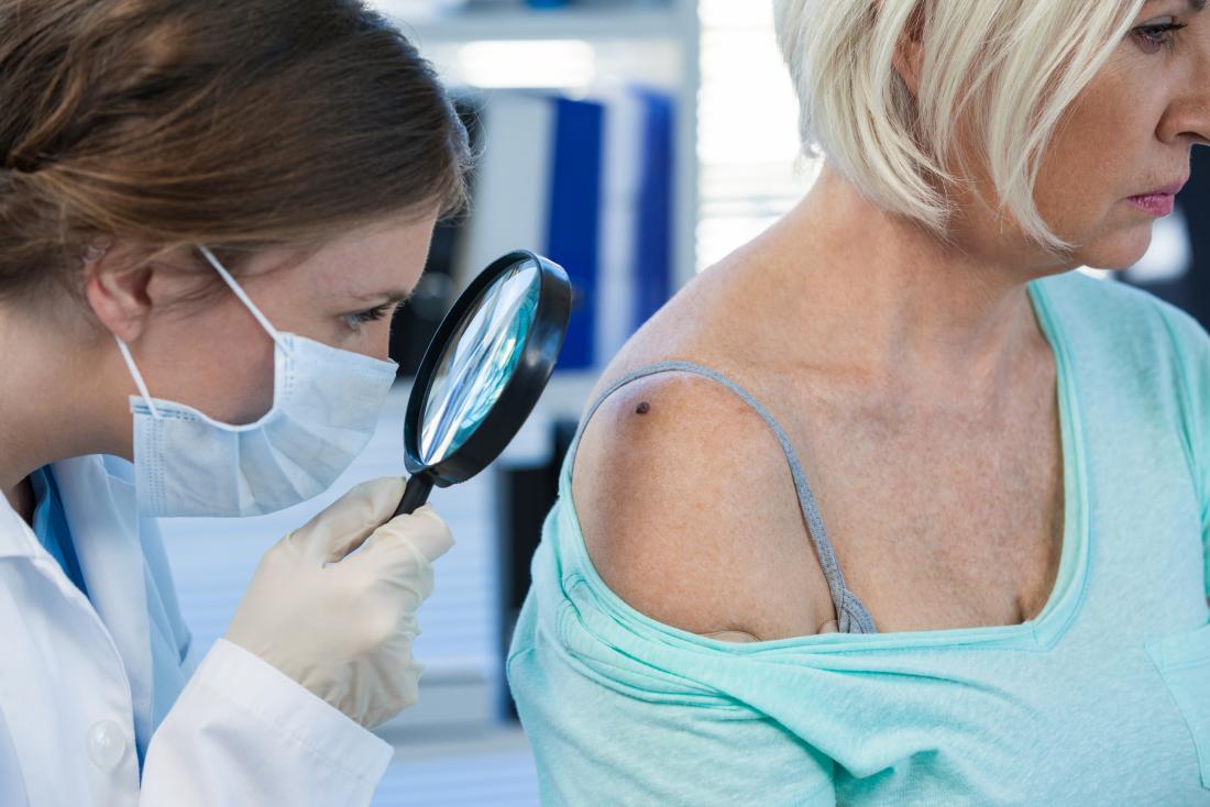 dermatologist examining a middle aged womans mole