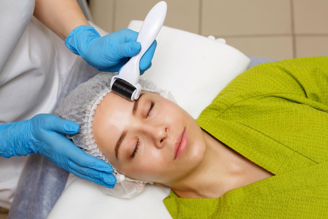 Woman having beauty treatment for forehead using dermaroller.
