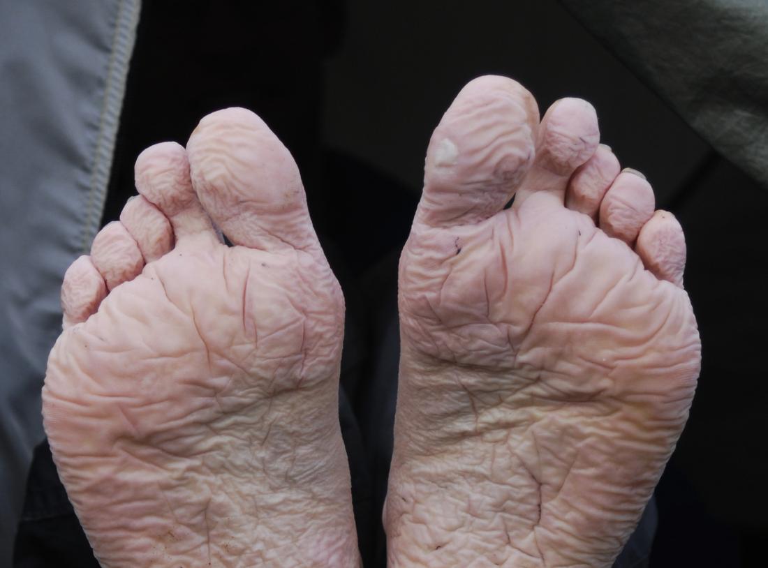 Deep wrinkled soles
