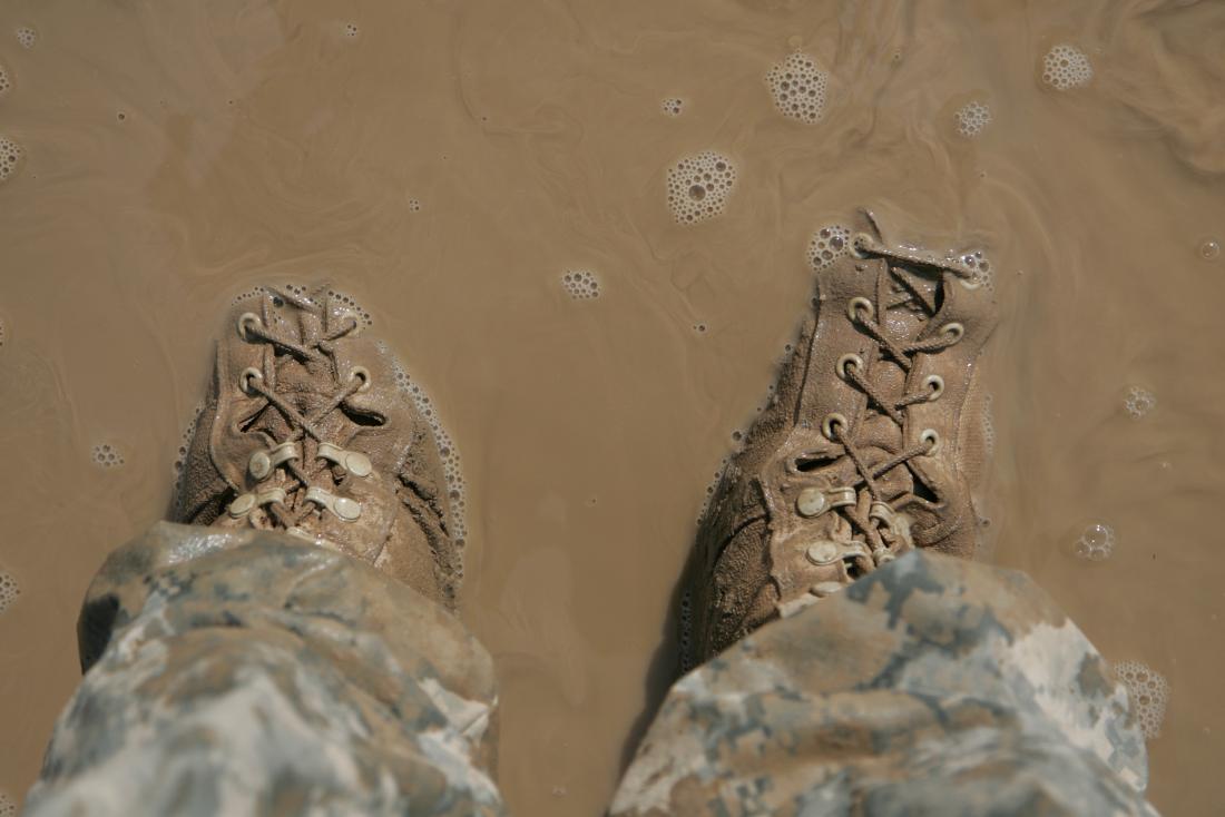 Trench Foot Symptoms Causes Treatment