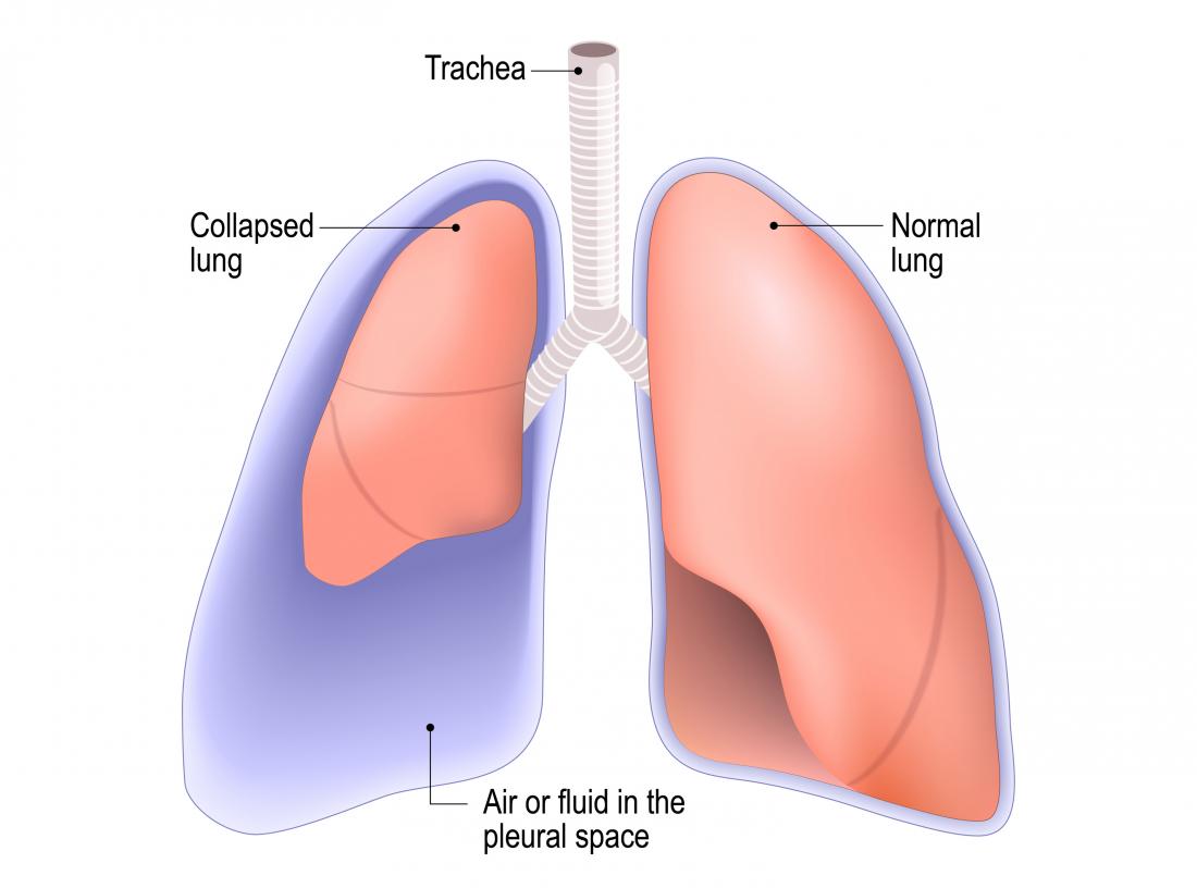 Lung - Pocket Anatomy