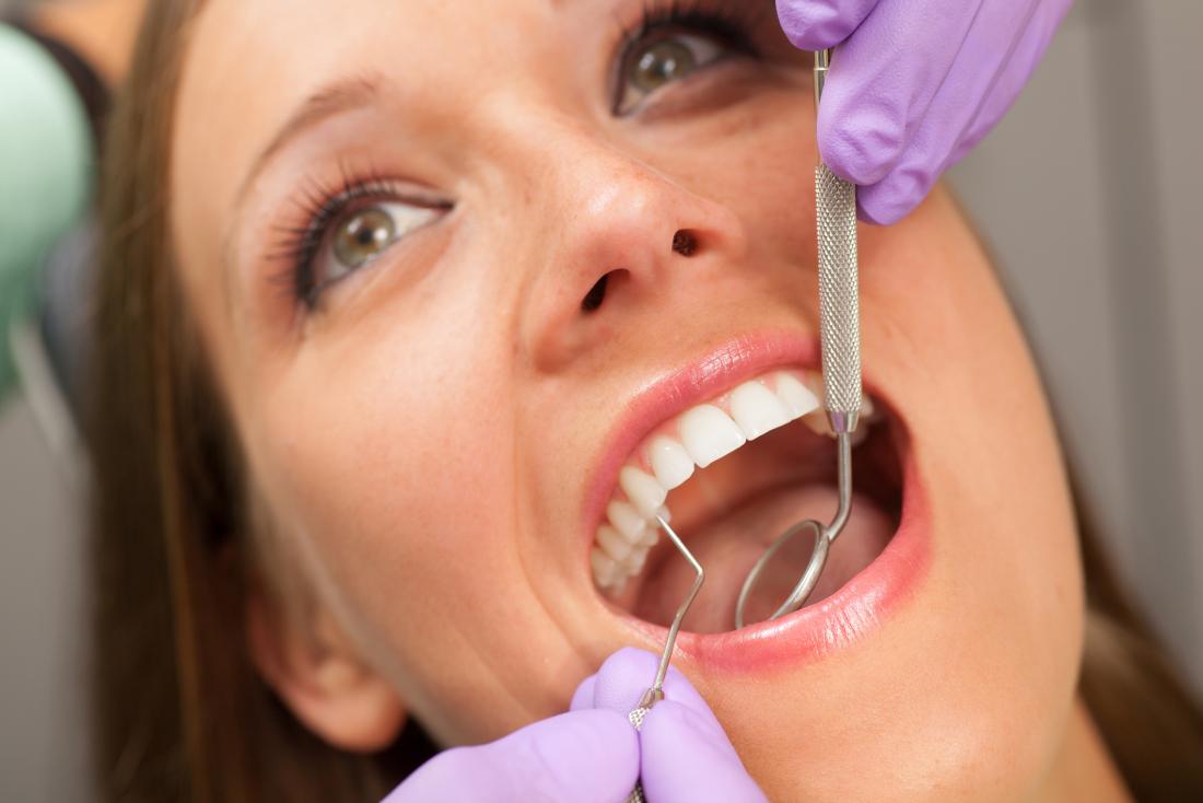 a woman having her teeth checked at the dentist