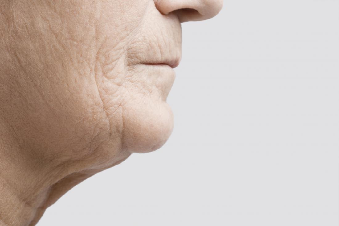 an image of a persons chin and jowls How To Avoid Loose Skin