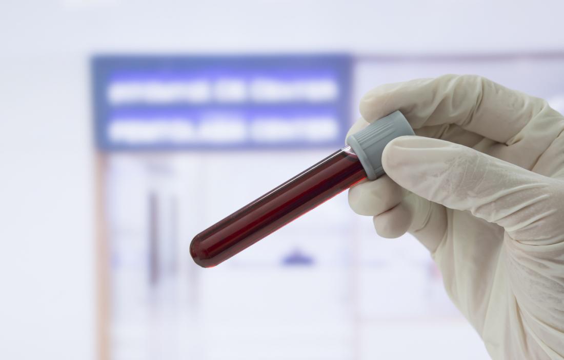 gloved hand holding a blood sample