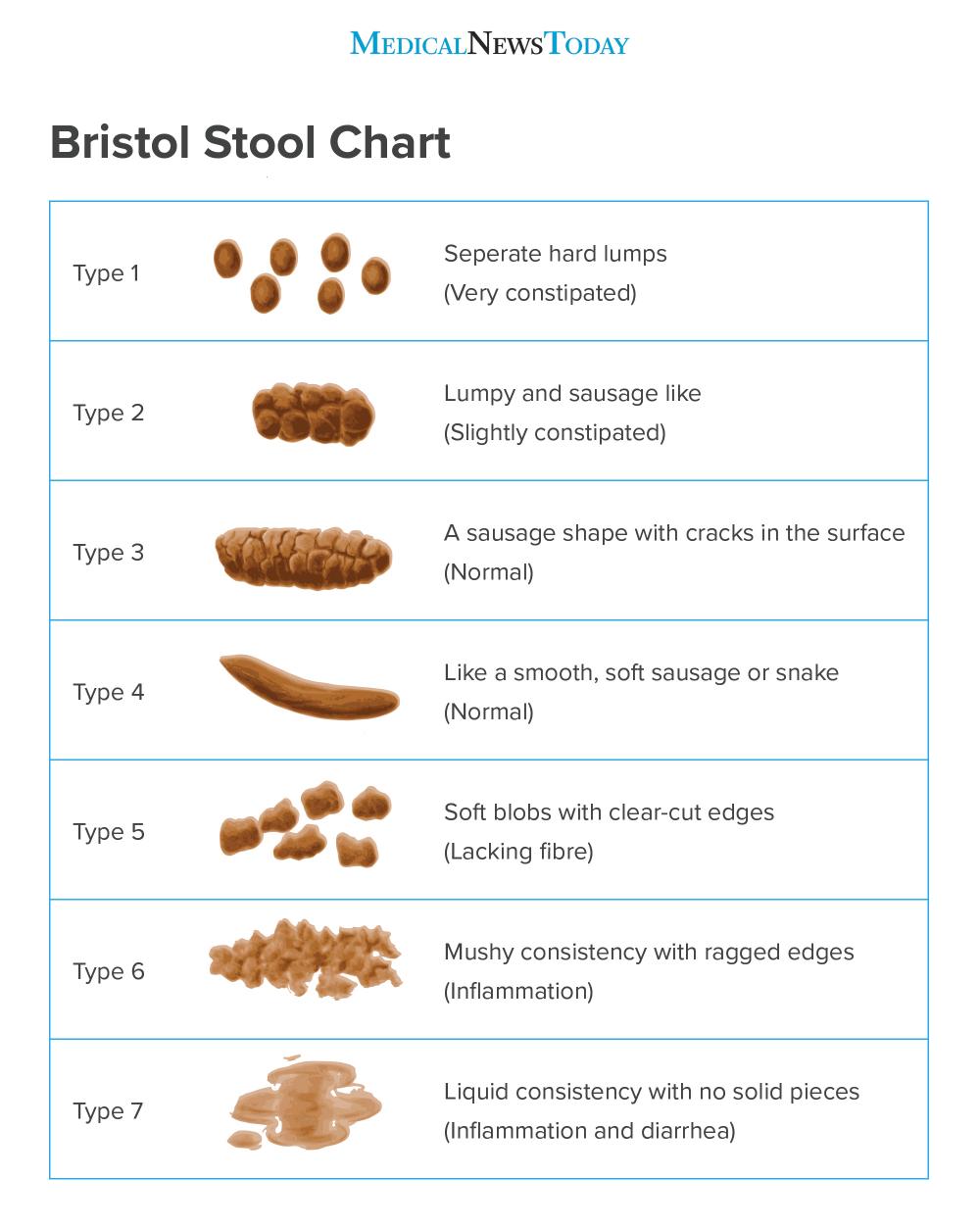 Types of poop: Appearance, color, and what is normal