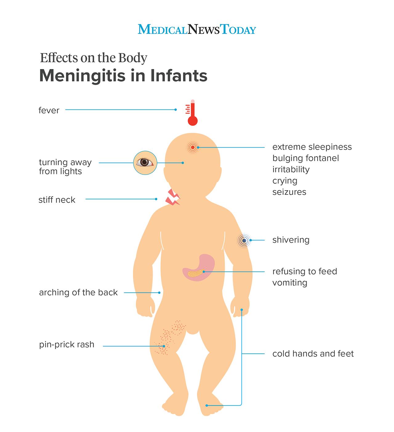 meningitis in infants effects on the body series br image credit stephen kelly 2019 br