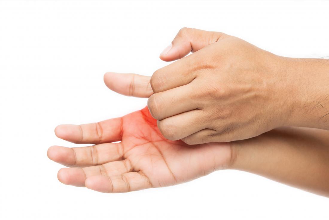 fordel Messing Rød dato Itchy palms: 6 causes, treatment, and prevention