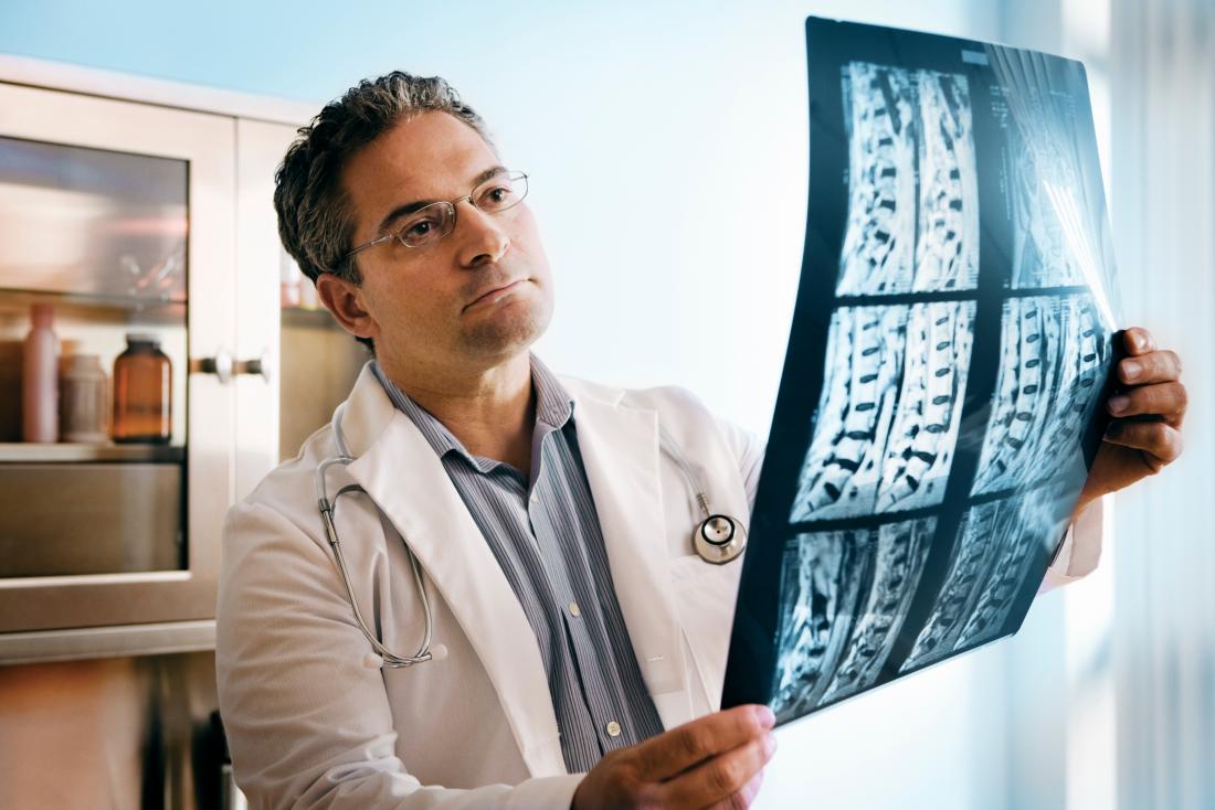 Doctor examining MRI and x-ray scans of spine.