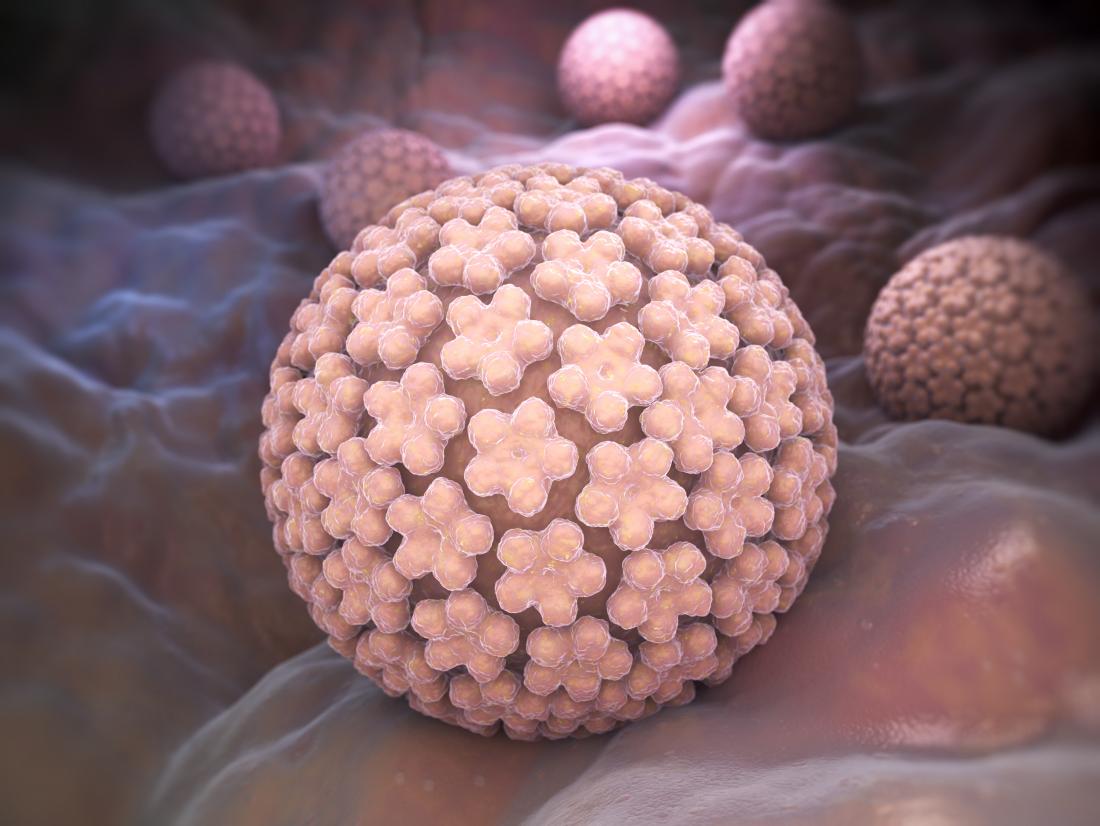 hpv virus that causes genital warts aggressive cancer of the soft tissue