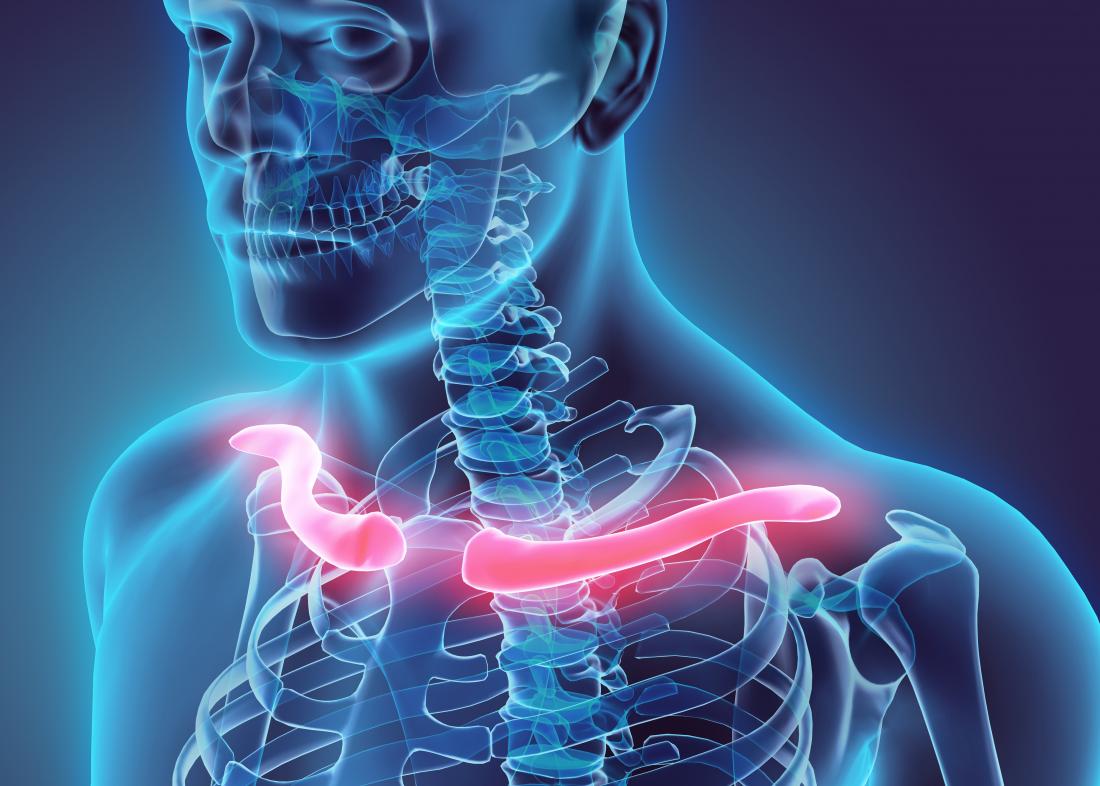 Collarbone (clavicle) pain: 8 causes