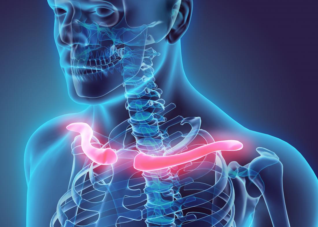 Collarbone clavicle Pain 8 Causes