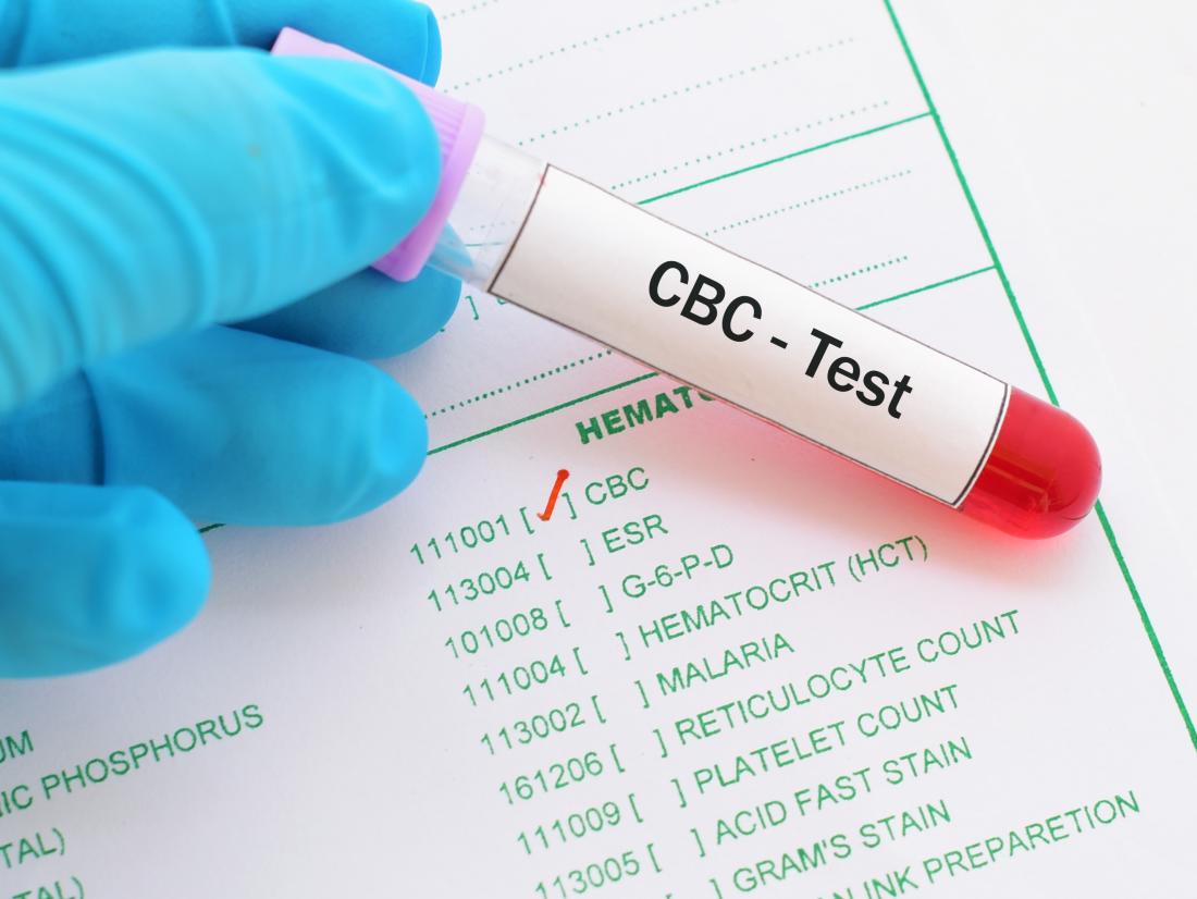 Cbc Test Results Chart