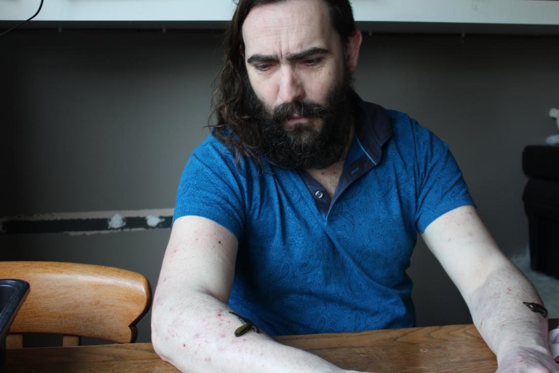stern Tim with his Leech friend