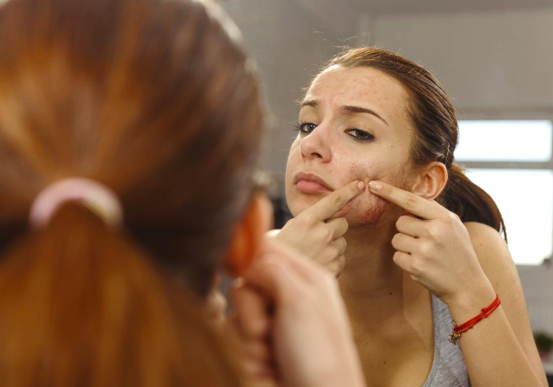 Woman looking at infected pimple on face in mirror, squeezing acne pimple on cheek.