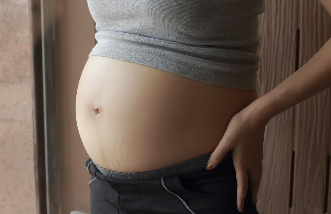 Close up of pregnant persons baby bump.
