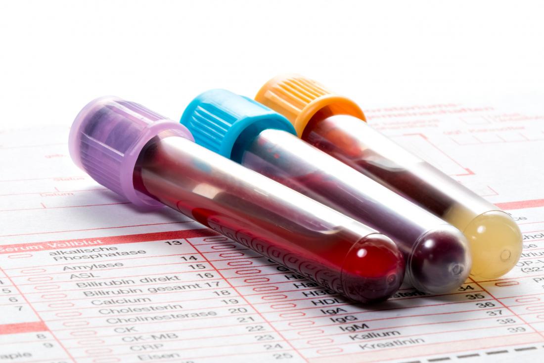blood samples in vials on paperwork