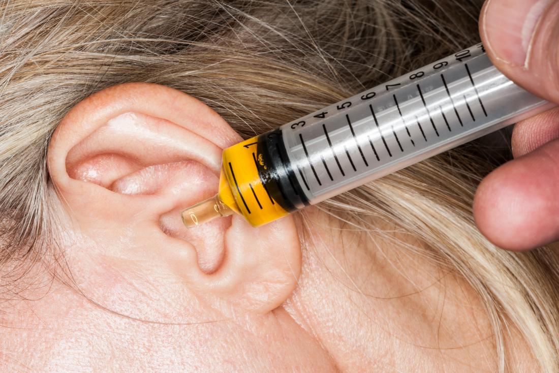 Ear drops of oil in syringe being dispensed into clogged ear.