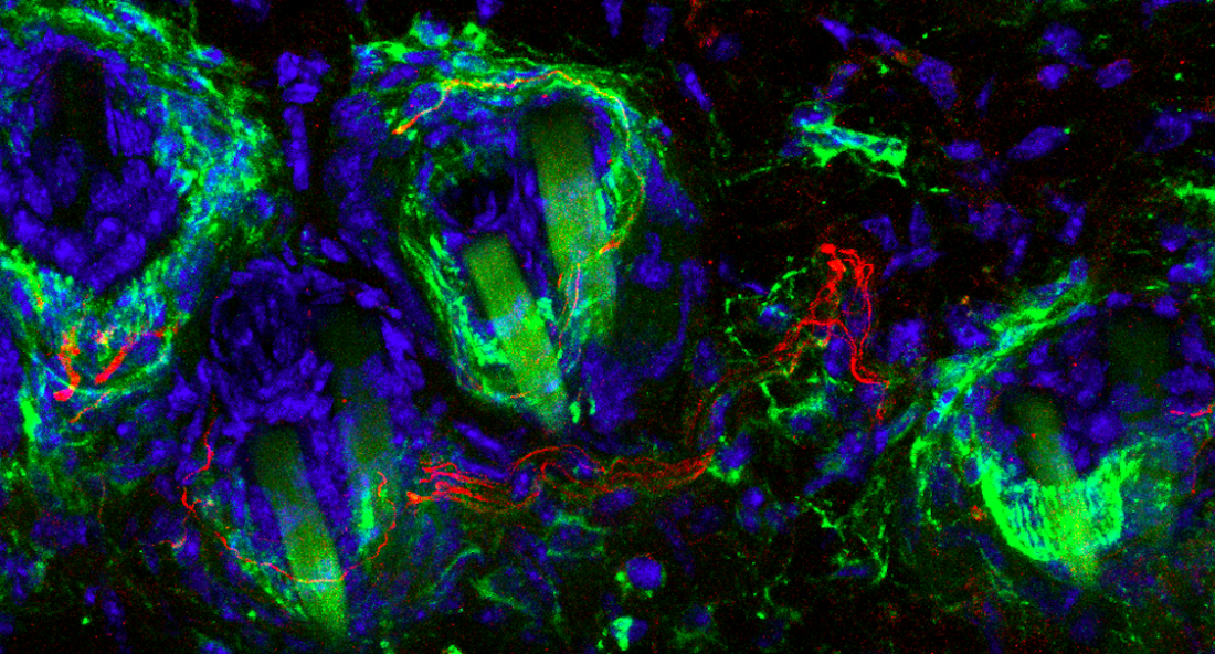 Sensitive mouse neurons