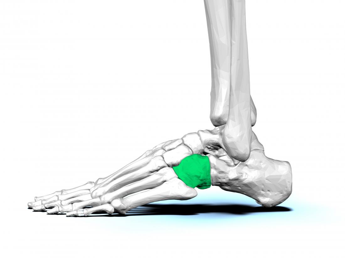 Cuboid syndrome: What it is, treatment 