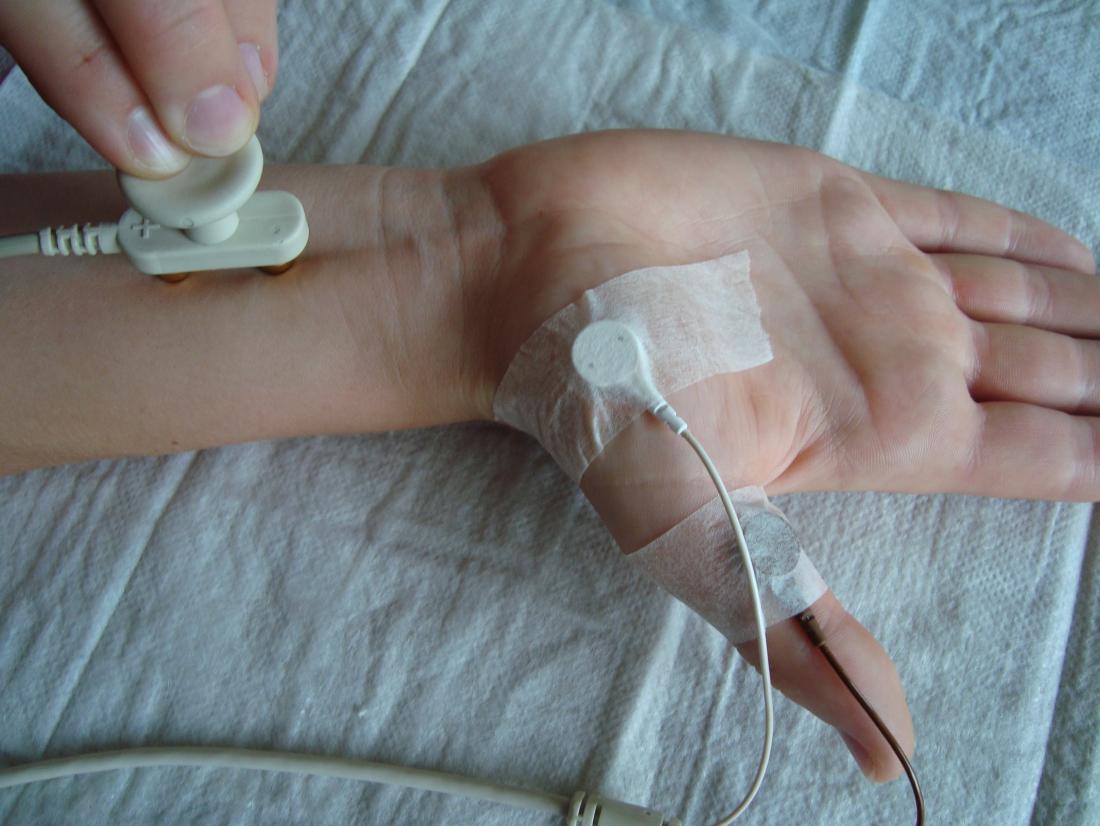 Nerve conduction velocity. Image credit: Kiwi-sonja, (2008, June 6).