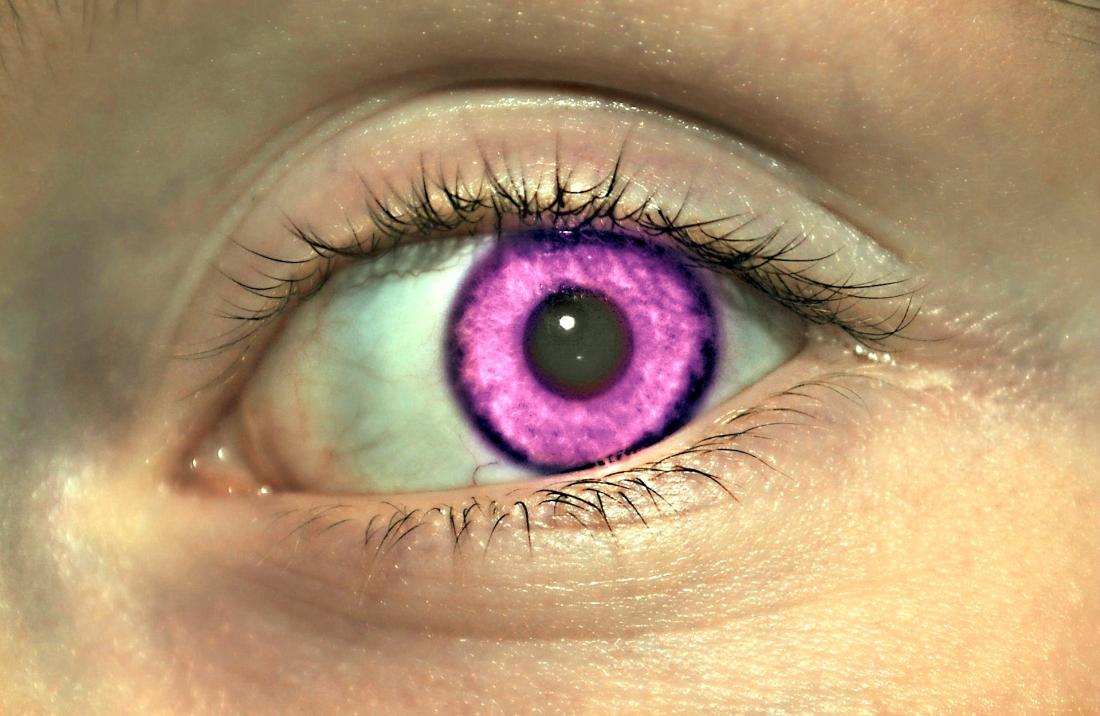 genetic mutation purple eyes