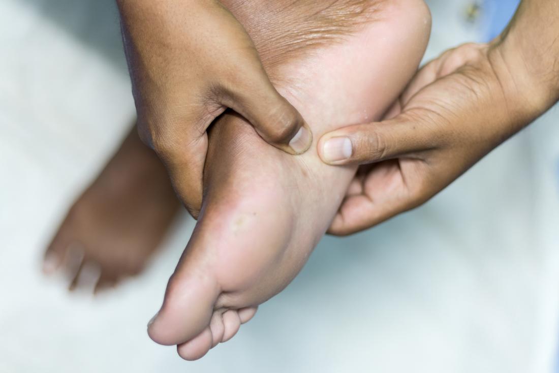 Plantar fibroma: Treatment, symptoms, and causes