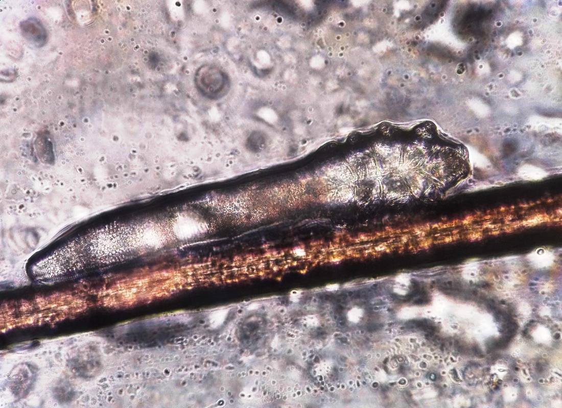 magnified image of the Demodex folliculorum mite <br>Image credit: Vladimir064, 2017</br>