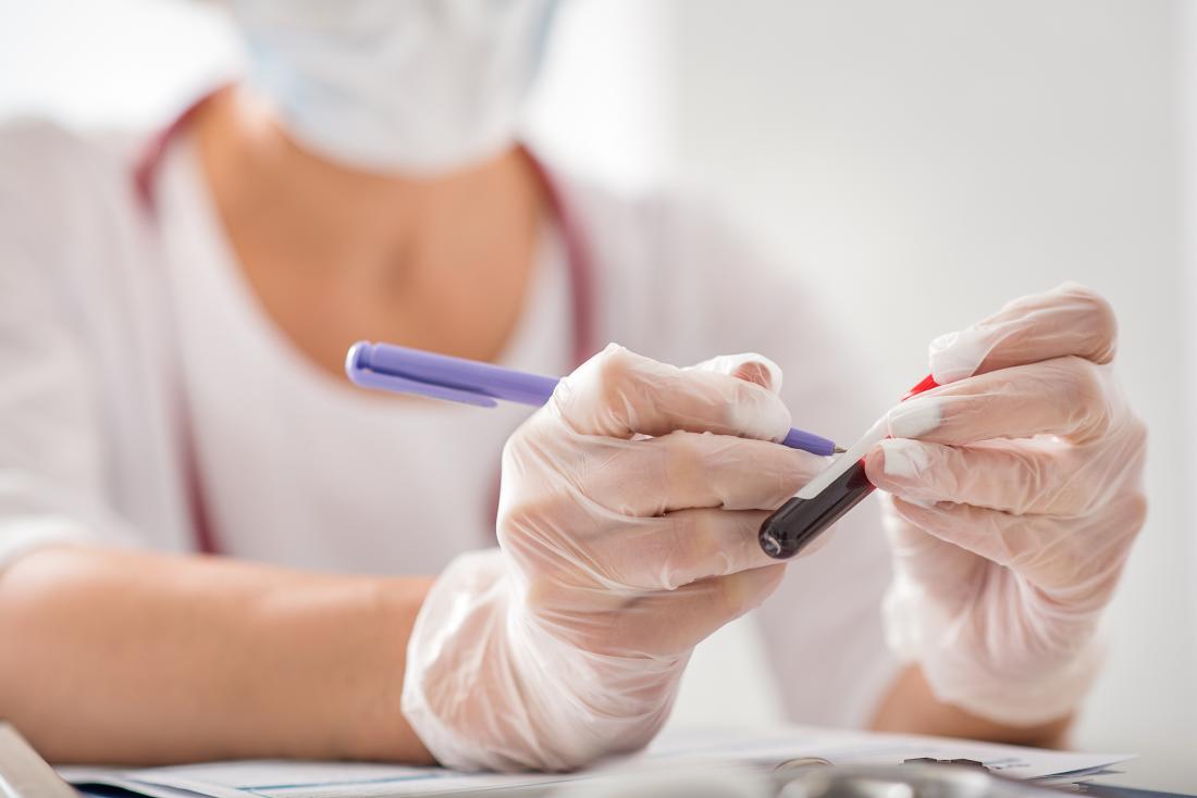 Blood sample being tested by lab technician