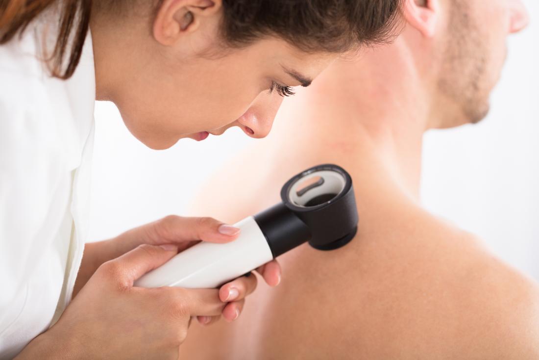 Weight Loss Reduces Skin Cancer Risk