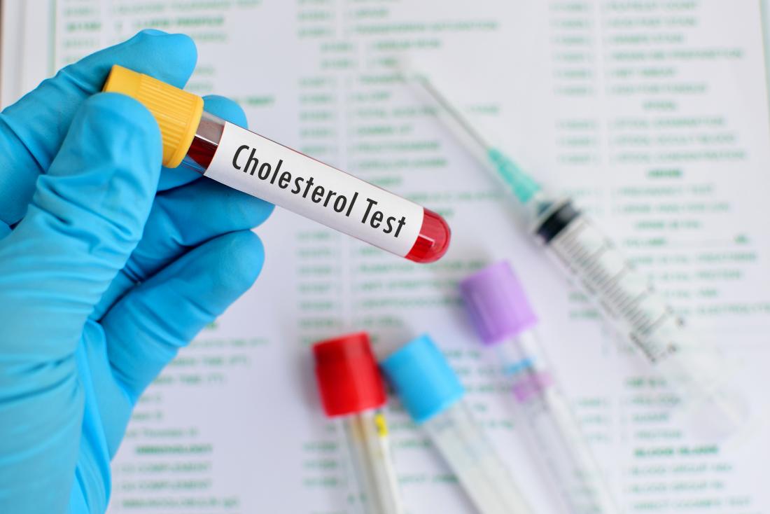 Liver and cholesterol What's the link?