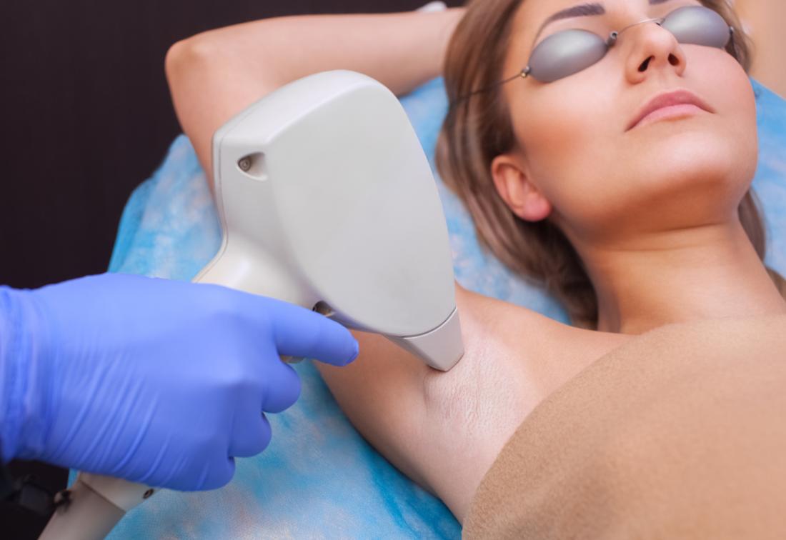 Is laser hair removal permanent and is it safe