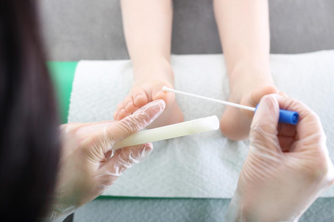 Vaginal wet mount test for vaginitis: What happens and what results mean