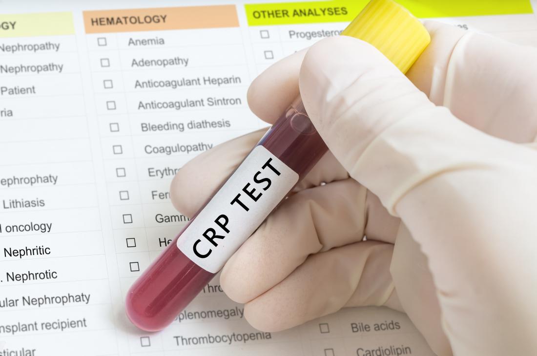C-reactive protein (CRP) test: High levels, low levels, and normal range