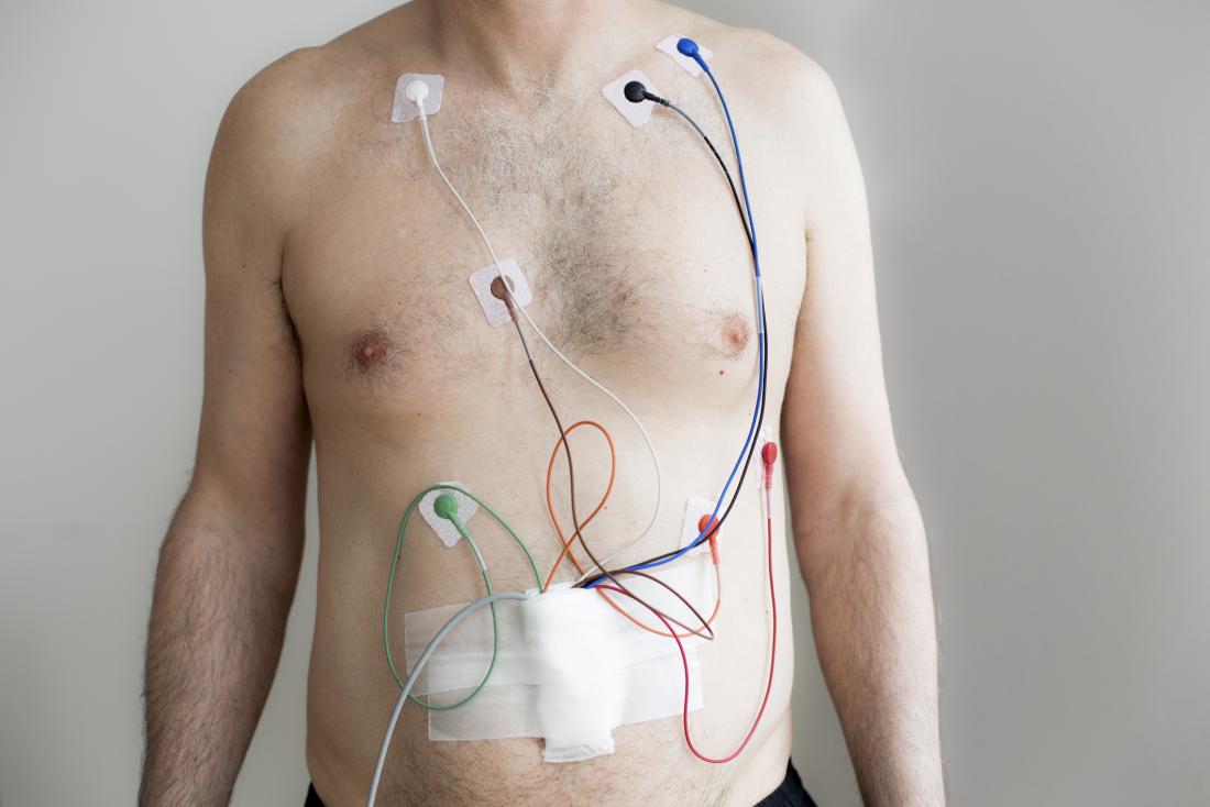 Holter ECG, informations pour le patient