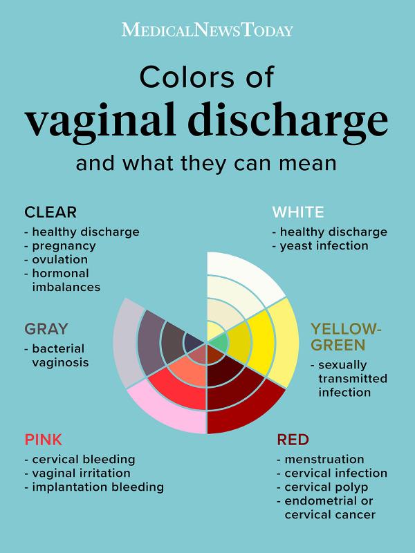 colours of vaginal discharge infographic | Stay at Home Mum.com.au